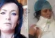 Credea că are o carie. La dentist, a urmat șocul: înăuntru era un gândac care-i devora carnea