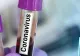 Coronavirus. 24 de tulceni au ieşit din autoizolare