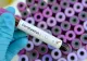 Coronavirus. 266 de decese si peste 5000 de noi cazuri raportate de Germania în ultimele 24 de ore