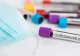 Coronavirus. Ce a făcut Israelul pentru 100.000 de teste COVID-19