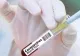 Bilanț oficial: 82 de decese cauzate de infecție cu coronavirus, în România