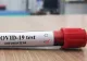 Alertă de coronavirus la un centru pentru persoane cu dizabilități din județul Prahova!