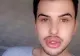 A vrut să fie perfect, dar cum și-a modificat corpul a șocat: până și buzele i-au explodat