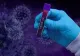 Noul coronavirus în România, 31 mai. Autoritățile anunță 124 de noi îmbolvăviri, cifră în scădere față de ieri