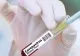 Bilanț oficial: 1156 de decese cauzate de infecție cu coronavirus, în România