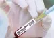 Coronavirus în România, bilanț oficial. SUTE de noi cazuri anunțate de autorități. Câți români s-au vindecat