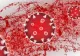 A fost confirmată OFICIAL accelerarea îmbolnăvirilor cu noul coronavirus în România. Care sunt județele cu probleme