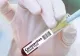 COVID-19: Aproape 100 de români, infectați în Austria. Ce transmite MAE