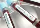 Asistente de la o maternitate privată din Timișoara, infectate cu Sars-Cov-2