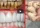 VIDEO – Amestecul care iți albește dinții într-un timp foarte scurt – Cum se prepară