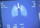 VIDEO/ CAMPANIE MEDICI: Boala nu ocolește pe nimeni! Experiențe din ATI și mărturii emoționante despre cei răpuși de COVID