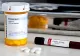 Primul medicament anti-Covid-19 care se va produce în România
