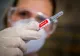 VIDEO | Medicul Ioan Gherghina, răspunsuri pentru persoanele care suferă de diverse boli și vor să se vaccineze