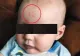 Medicii, uimiţi de semnul care i-a apărut unui bebeluş pe frunte, după naştere FOTO