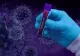 Bilanț coronavirus 25 ianuarie. Informații oficiale - 1. 551 de cazuri noi, 65 de decese