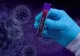 Bilanț coronavirus 28 ianuarie. Cifre oficiale - informații LIVE: 2.901 cazuri noi, 90 de decese