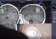 VIDEO | Femeie cu tumoră cerebrală de 5 centimetri, operată cu succes în Iași. Declarațiile emoționante ale pacientei