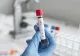 Caz medical extrem de rar: O femeie s-a vindecat de HIV fără tratament