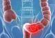 Leguma banală care previne cancerul intestinal și prelungește viața