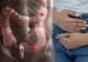 Cel mai periculos obicei alimentar care crește riscul de cancer la colon