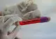 Medic, avertisment tulburător despre evoluţia rapidă a tulpinii Omicron. Ce ne așteaptă în perioada următoare