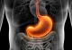 Alimentele interzise în GASTRITĂ. Când devine o afecțiune periculoasă și este nevoie de biopsie