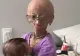 Adalia Rose Williams, "fetița bătrână", a murit la vârsta de 15 ani