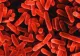 Date OFICIALE. Cazuri de Legionella în România, în 2021 - Cum se manifestă „boala legionarilor”. Este mortală