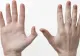 Simptomele cancerului apar prima dată pe mâini. Cum arată