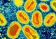 „Variola maimuțelor”, noul virus care lovește Europa. Anglia, Spania și Portugalia se confruntă deja cu primele cazuri