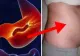 Bacteria care distruge stomacul. Se poate afla în corpul tău fără să îţi dai seama