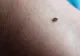 A murit la o oră după ce a fost înțepat de o insectă. Sfârșit tragic pentru un tânăr din Dâmbovița  