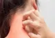 Alergia la latex - simptomele care trebuie să te trimită la medic