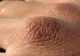 Cancerul apare mai întâi pe mâini. Primele semne care ar trebui să te îngrijoreze