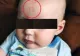 Medicii, uimiţi de semnul care i-a apărut unui bebeluş pe frunte, după naştere FOTO
