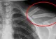 Otrava asta îţi distruge oasele! O bei în fiecare zi fără să știi cât de toxică este pentru organism