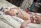 Bebeluș de 5 luni, infectat cu FLURONA (gripa + COVID) na la Iași. Medicii sunt în alertă