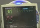 Bucătăreasa unui spital din Suceava găsită inconștientă în baia unității medicale! Femeia s-ar fi intoxicat cu sodă caustică