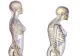 Studiu alarmant: poluarea aerului ar putea provoca OSTEOPOROZĂ