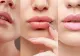Un salon în care se făceau proceduri cosmetice de augmentare a buzelor, AMENDAT CU 40.000 lei