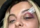 Cântăreața Bebe Rexha, lovită în cap cu un telefon, în timpul concertului. S-a prăbușit pe scenă - VIDEO