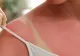 România sub caniculă. Leacuri băbești împotriva arsurilor solare