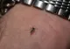 Bărbat din județul Dolj, confirmat cu infecție cu virusul West Nile. Medicii, exasperați de numărul pacienților înțepați de insecte 