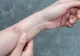 Vânătăile ce apar din senin, semnal de alarmă - Alte simptome ale lipsei de vitamine K și C - Remedii naturale