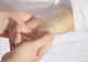Ce simptome are boala „mâncătoare de carne”. Bacteria se răspândește rapid în România