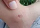 Pericolul care îi pândește pe copii în Lacul Tineretului din Capitală! Micuții pot fi oricând mușcați: semnalul de alarmă transmis pe un grup de Facebook