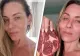 O femeie care a renunțat la dieta vegană și a trecut la una bazată doar pe hrană de origine animală a dezvăluit schimbările incredibile din corpul ei