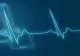 De ce apar bătăile neregulate ale inimii. Ce sfaturi dau doctorii, dacă te confrunți cu aritmii cardiace