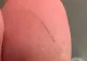 VIDEO. Trucul prin care scoţi rapid aşchiile de sub piele. Nu este nevoie de ac și nici nu o să doară