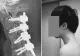 Avertisment dur al medicilor: un tânăr a ajuns să nu-și mai poată ridica capul din cauza statului excesiv pe telefon. Cât de mult ne afectează viața acest obicei?